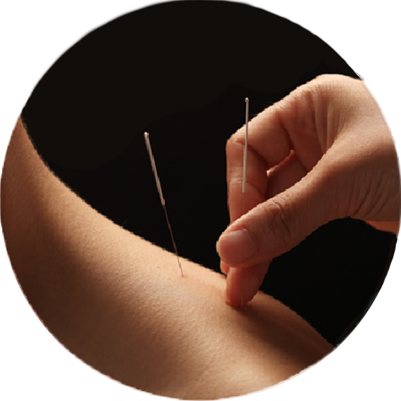 Acupuncture session overview